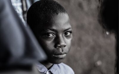 Malnutrition Conditions: Marasmus & Kwashiorkor